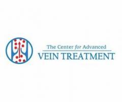 The Center of Vein Treatment