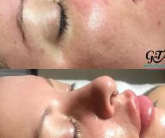 Glam by Tam Aesthetics LLC | Medical Spa | Dermaplaning in Madison WI