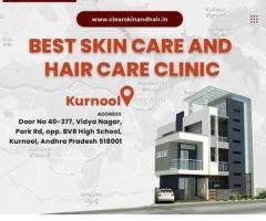 skin doctor best in kurnool