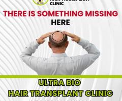 Best hair transplant in chennai